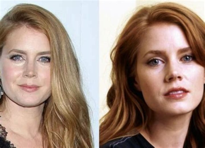 Amy Adams Plastic Surgery Before and After