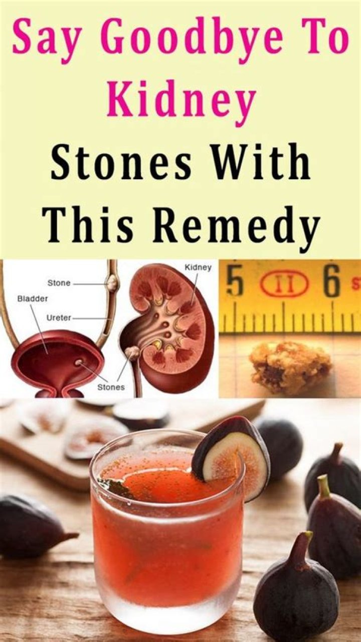 Say Goodbye To Kidney Stones With This Remedy